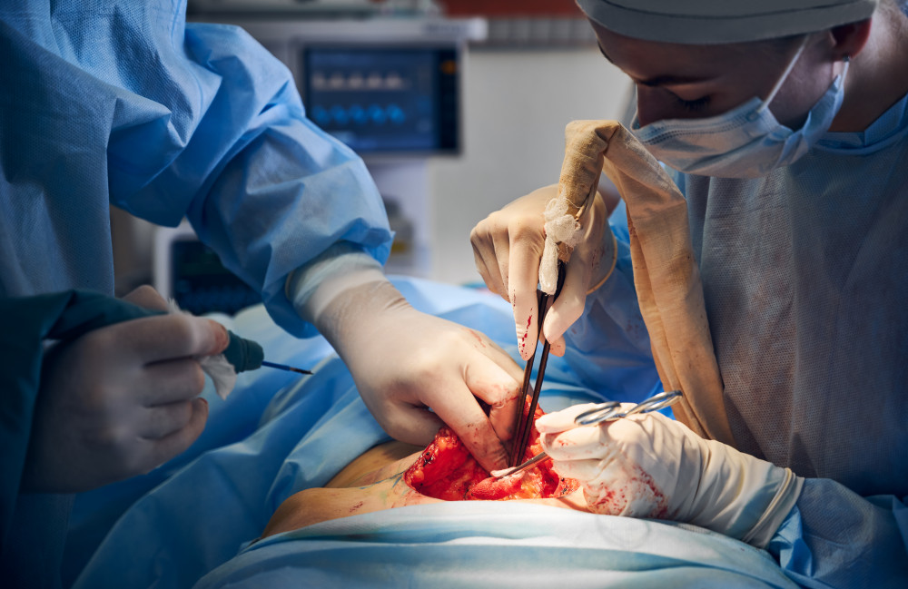 Abdominoplastie : quand la faire ?