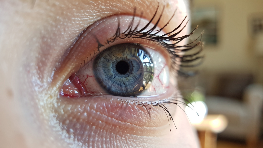 Oeil qui gratte coin interne : causes et solutions rapides