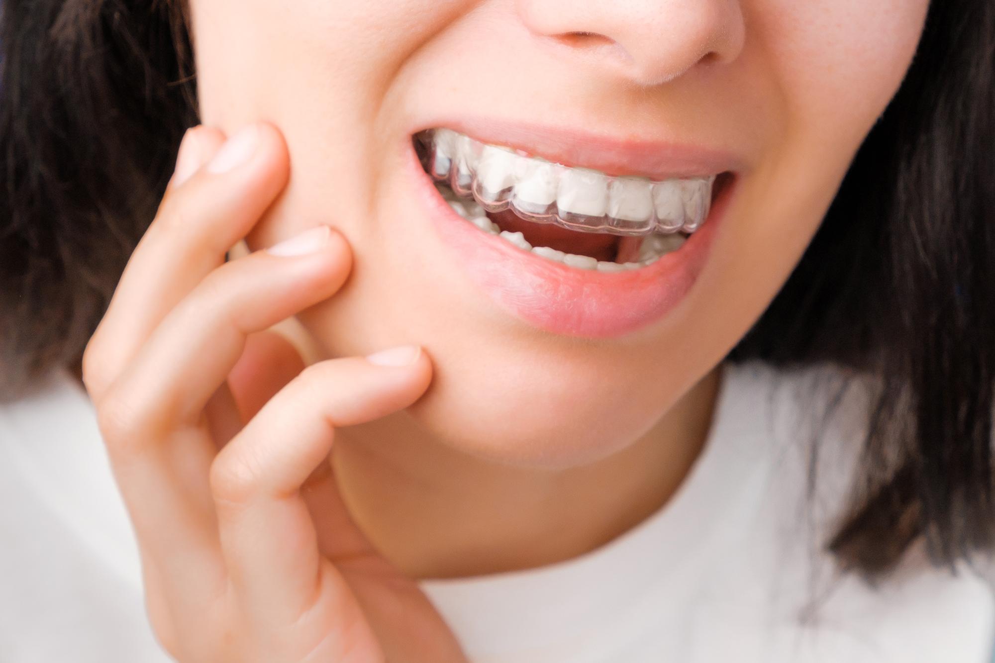 Invisalign Genève – alternative discrète aux appareils traditionnels